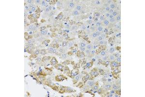 Immunohistochemistry of paraffin-embedded rat liver using TROVE2 antibody (ABIN5975457) at dilution of 1/100 (40x lens). (TROVE2 Antikörper)