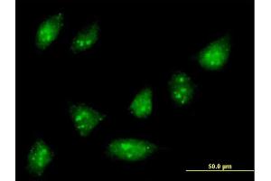 Immunofluorescence of purified MaxPab antibody to ZNF576 on HeLa cell. (ZNF576 Antikörper  (AA 1-170))