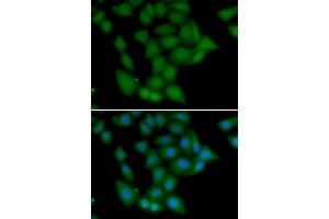 Immunofluorescence analysis of U2OS cells using CAMK1 antibody (ABIN5974223). (CAMK1 Antikörper)
