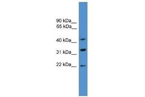 Western Blot showing ARFIP1 antibody used at a concentration of 1-2 ug/ml to detect its target protein. (ARFIP1 Antikörper  (C-Term))