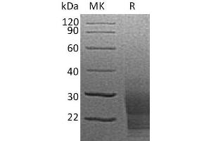 Western Blotting (WB) image for KIT Ligand (KITLG) protein (His tag) (ABIN7320808) (KIT Ligand Protein (KITLG) (His tag))