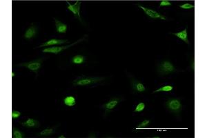 Immunofluorescence of monoclonal antibody to ID1 on HeLa cell. (ID1 Antikörper  (AA 47-155))