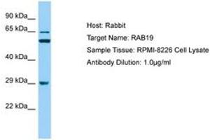 Image no. 1 for anti-RAB19, Member RAS Oncogene Family (RAB19) (AA 40-89) antibody (ABIN6749888) (RAB19 Antikörper  (AA 40-89))