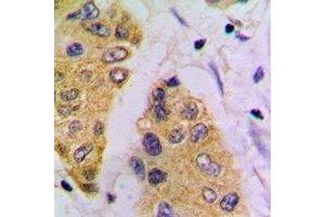 Immunohistochemical analysis of FBP1 staining in mouse pancreas formalin fixed paraffin embedded tissue section. (FBP1 Antikörper)
