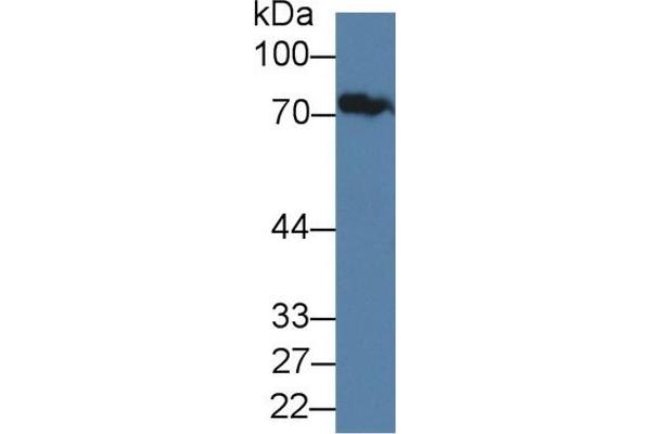 Junctophilin 1 Antikörper  (AA 1-201)