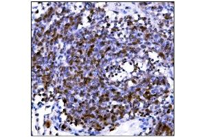 IHC analysis of PML Protein/Pml using anti-PML Protein/Pml antibody (ABIN7599678). (PML Antikörper  (AA 107-857))
