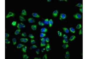 Immunofluorescence staining of Hela cells with ABIN7175196 at 1:133, counter-stained with DAPI. (VSIG8 Antikörper  (AA 285-414))