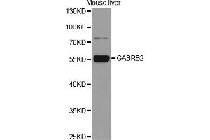 Western blot analysis of extracts of mouse liver, using GABRB2 antibody (ABIN5970962) at 1/1000 dilution. (GABRB2 Antikörper)