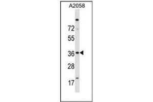 Western blot analysis of Islet-2 / ISL2 Antibody (N-term) in A2058 cell line lysates (35ug/lane). (ISL2 Antikörper  (N-Term))