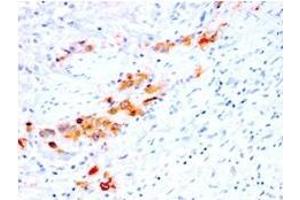 Formalin-fixed, paraffin-embedded human Bladder stained with CD44v4 Mouse Recombinant Monoclonal Antibody (rCD44v4/1219). (Rekombinanter CD44 Antikörper)