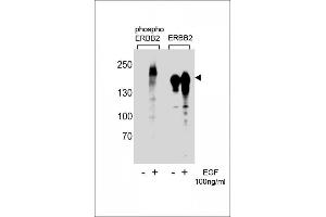 Image no. 2 for anti-Receptor tyrosine-protein kinase erbB-2 (ErbB2/Her2) (pTyr1222) antibody (ABIN3029506)