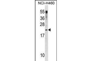 CSF3 Antibody (C-term) (ABIN1881232 and ABIN2838611) western blot analysis in NCI- cell line lysates (35 μg/lane). (G-CSF Antikörper  (C-Term))