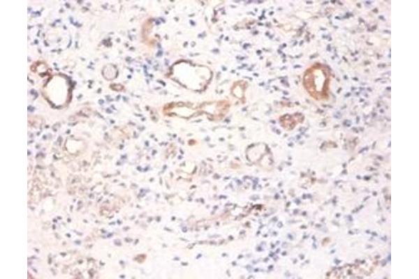 Pyruvate Kinase, Muscle (PKM) Antikörper (HRP)