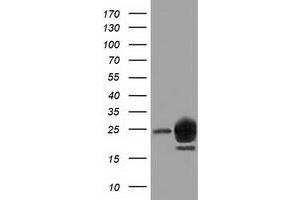 Western Blotting (WB) image for anti-Lin-7 Homolog B (LIN7B) antibody (ABIN1499157) (LIN7B Antikörper)