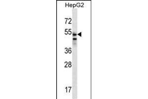 SLC29A3 Antibody (N-term) (ABIN656792 and ABIN2846011) western blot analysis in HepG2 cell line lysates (35 μg/lane).