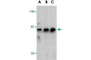 Western blot analysis of BTK in U-937 cell lysate with BTK polyclonal antibody  at (A) 0.