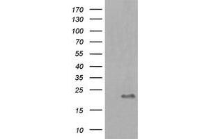 Image no. 1 for anti-HRas proto-oncogene, GTPase (HRAS) antibody (ABIN1498717) (HRAS Antikörper)