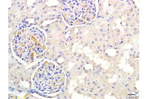 Formalin-fixed and paraffin embedded rat kidney labeled with Anti PNMT Polyclonal Antibody, Unconjugated  at 1:300 followed by conjugation to the secondary antibody and DAB staining (PNMT Antikörper  (AA 101-200))