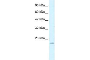 WB Suggested Antibody  Titration: 0. (FOXP2 Antikörper  (N-Term))