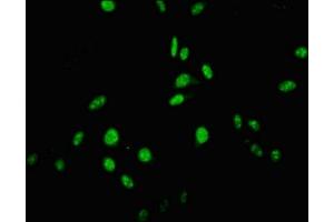 Immunofluorescent analysis of Hela cells using ABIN7174288 at dilution of 1:100 and Alexa Fluor 488-congugated AffiniPure Goat Anti-Rabbit IgG(H+L) (USP22 Antikörper  (C-Term))