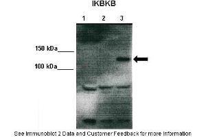 Lanes:   Lane 1: 10ug 293T lysate (empty vector) Lane 2: 10ug IKKalpha-V5 transfected 293T lysate Lane 3: 10ug IKKbeta-V5 transfected 293T  Primary Antibody Dilution:    1:1000  Secondary Antibody:   Anti-rabbit HRP  Secondary Antibody Dilution:    1:2000  Gene Name:   IKBKB  Submitted by:   Dr. (IKBKB Antikörper  (Middle Region))