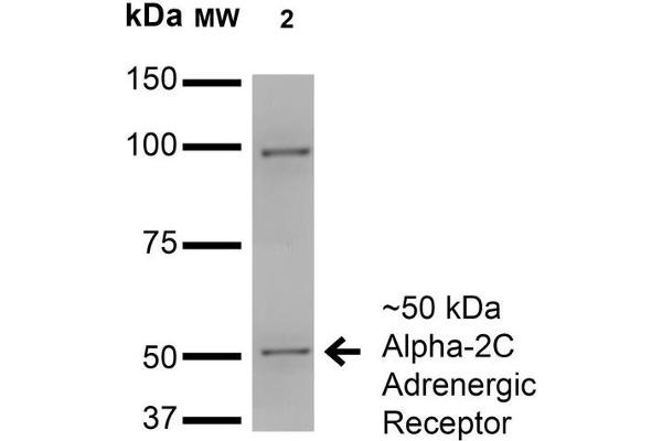 ADRA2C Antikörper  (AA 442-462) (FITC)