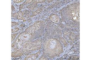IHC analysis of HLA-DRA using anti-HLA-DRA antibody (ABIN7600950). (HLA-DRA Antikörper  (AA 26-254))