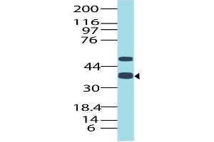 Image no. 1 for anti-Transcription Termination Factor, RNA Polymerase I (TTF1) (AA 21-286) antibody (ABIN5027609) (TTF1 Antikörper  (AA 21-286))