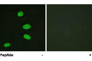 Immunofluorescence analysis of HeLa cells, using RBL2 polyclonal antibody . (p130 Antikörper)