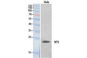 Western Blotting (WB) image for anti-Neurotensin (NTS) (Internal Region) antibody (ABIN3178551) (Neurotensin Antikörper  (Internal Region))