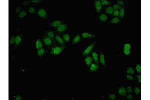 Immunofluorescent analysis of HepG2 cells using ABIN7150116 at dilution of 1:100 and Alexa Fluor 488-congugated AffiniPure Goat Anti-Rabbit IgG(H+L) (DNMT3B Antikörper  (AA 1-100))