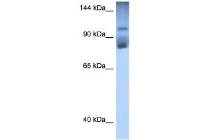 WB Suggested Anti-HIPK2 Antibody Titration:  0. (HIPK2 Antikörper  (Middle Region))
