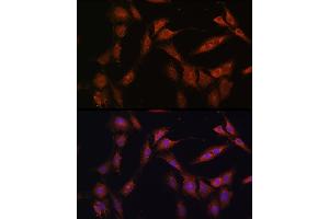 Immunofluorescence analysis of C6 cells using PFKFB2 Rabbit pAb (ABIN6129842, ABIN6145483, ABIN6145484 and ABIN6224971) at dilution of 1:100 (40x lens).