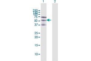 Western Blot analysis of ZSCAN20 expression in transfected 293T cell line by ZSCAN20 MaxPab polyclonal antibody.