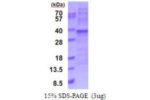 SDS-PAGE (SDS) image for Ribosomal Protein L7a (RPL7A) (AA 1-266) protein (His tag) (ABIN5777746) (RPL7A Protein (AA 1-266) (His tag))