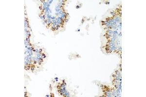 Immunohistochemistry (IHC) image for anti-UbiA Prenyltransferase Domain Containing 1 (UBIAD1) (AA 1-100) antibody (ABIN6149845)