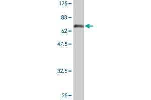 Western Blot detection against Immunogen (74. (Fatty Acid Synthase Antikörper  (AA 1-439))