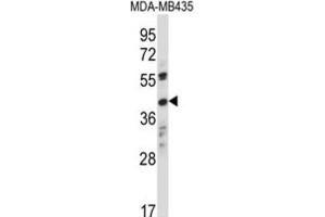 Western Blotting (WB) image for anti-Olfactory Receptor, Family 8, Subfamily K, Member 1 (OR8K1) antibody (ABIN2997661) (OR8K1 Antikörper)