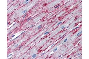 PNPT1 antibody was used for immunohistochemistry at a concentration of 4-8 ug/ml. (PNPT1 Antikörper  (Middle Region))