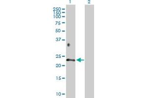 Western Blot analysis of BTC expression in transfected 293T cell line by BTC MaxPab polyclonal antibody. (Betacellulin Antikörper  (AA 1-178))