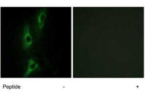 Immunofluorescence analysis of NIH/3T3 cells, using ADRB2 polyclonal antibody . (beta 2 Adrenergic Receptor Antikörper  (C-Term))