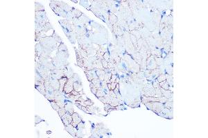 Immunohistochemistry of paraffin-embedded mouse heart using Flotillin 1 Rabbit mAb (ABIN3017206, ABIN3017207, ABIN1680028 and ABIN1680029) at dilution of 1:100 (40x lens). (Flotillin 1 Antikörper)