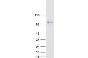 Western Blotting (WB) image for Signal-Regulatory Protein alpha (SIRPA) (Transcript Variant 3) protein (Myc-DYKDDDDK Tag) (ABIN2713466)