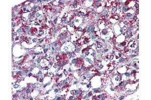 Immunohistochemistry (IHC) image for anti-Angiotensin II Receptor, Type 2 (AGTR2) (Internal Region) antibody (ABIN1048323)