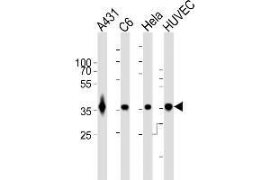 All lanes : Anti-GDH Antibody at 1:1000 dilution Lane 1: A431 whole cell lysates Lane 2: C6 whole cell lysates Lane 3: Hela whole cell lysates Lane 4: HUVEC whole cell lysates Lysates/proteins at 20 μg per lane. (GAPDH Antikörper)