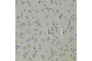 Immunohistochemistry of paraffin-embedded mouse brain using RPL9 Antibody. (RPL9 Antikörper)