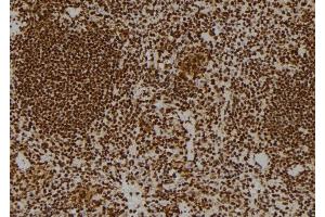 ABIN6264437 and ABIN6269102 at 1/100 staining Mouse spleen tissue by IHC-P. (Progesterone Receptor Antikörper  (Internal Region))