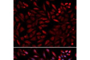 Immunofluorescence analysis of U2OS cells using PSMC2 Polyclonal Antibody (PSMC2 Antikörper)