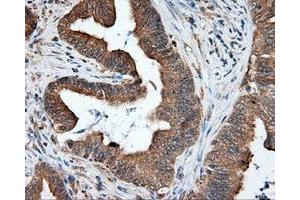 Immunohistochemical staining of paraffin-embedded liver tissue using anti-RC219453 mouse monoclonal antibody.