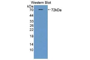 Western blot analysis of the recombinant protein. (STAM2 Antikörper  (AA 1-377))